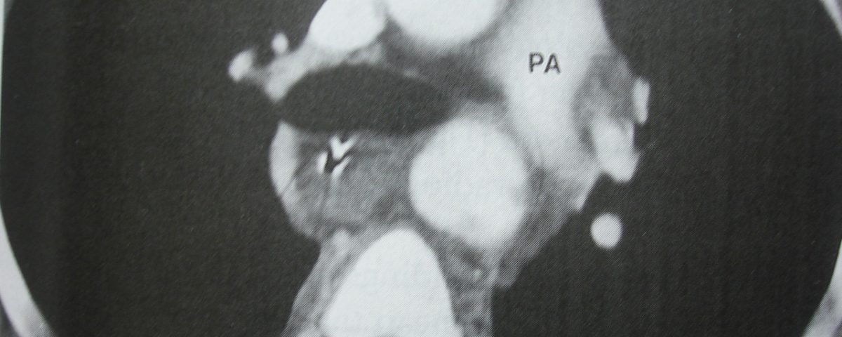 Abdomen  Anatomy, Referenced Image